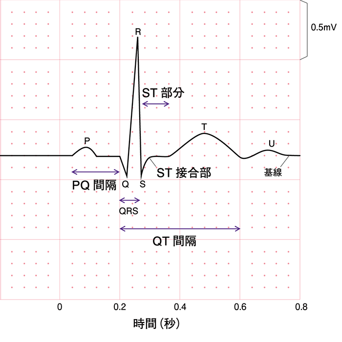 正常な心電図波形