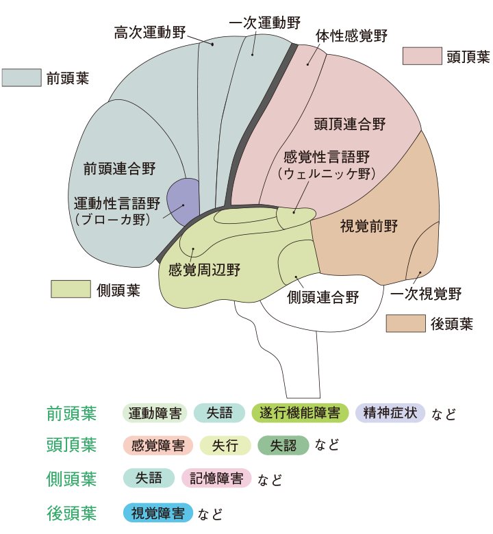 大脳の障害部位と主な後遺症