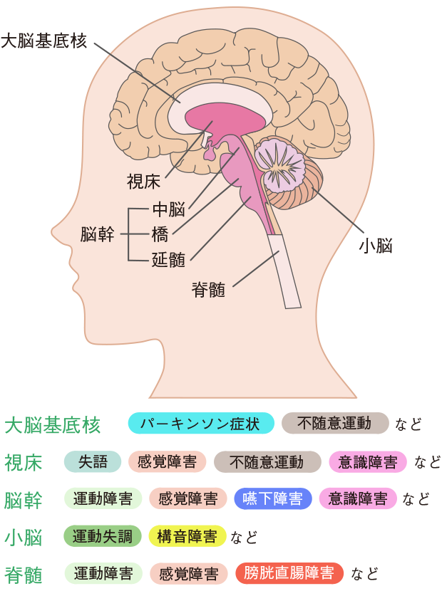 大脳以外の障害部位と主な症状