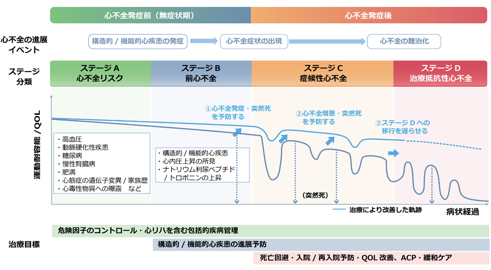 心不全とそのリスクの進展ステージ