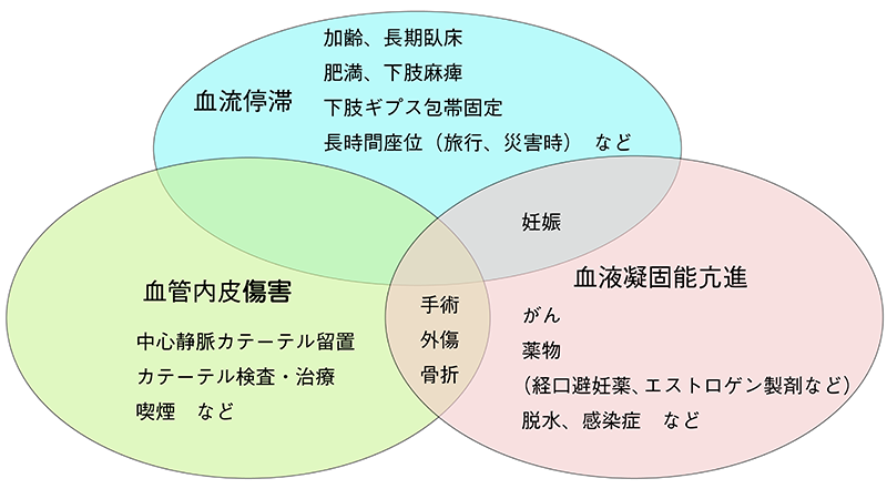 静脈血栓塞栓症の主な原因