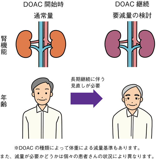 DOAC減量の検討