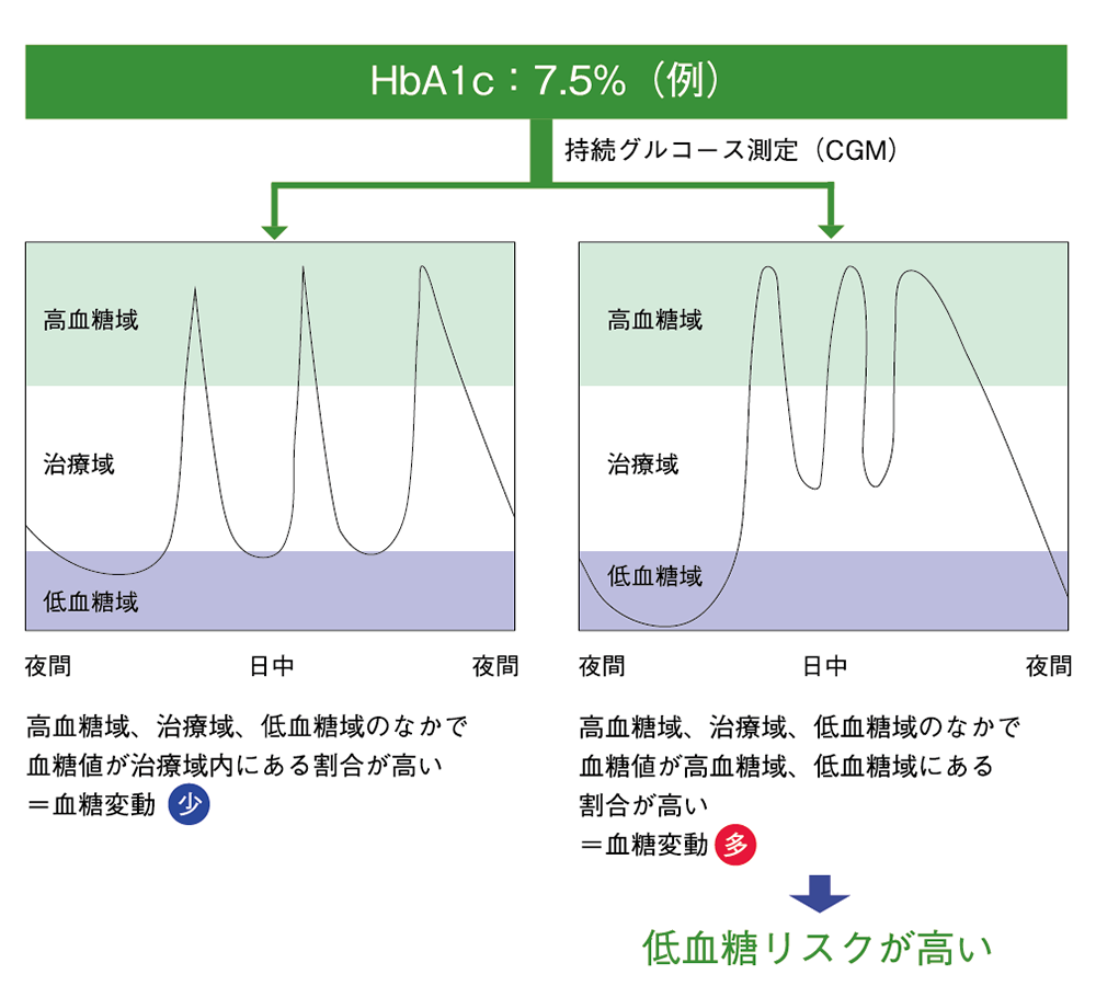 CGMによる血糖変動測定