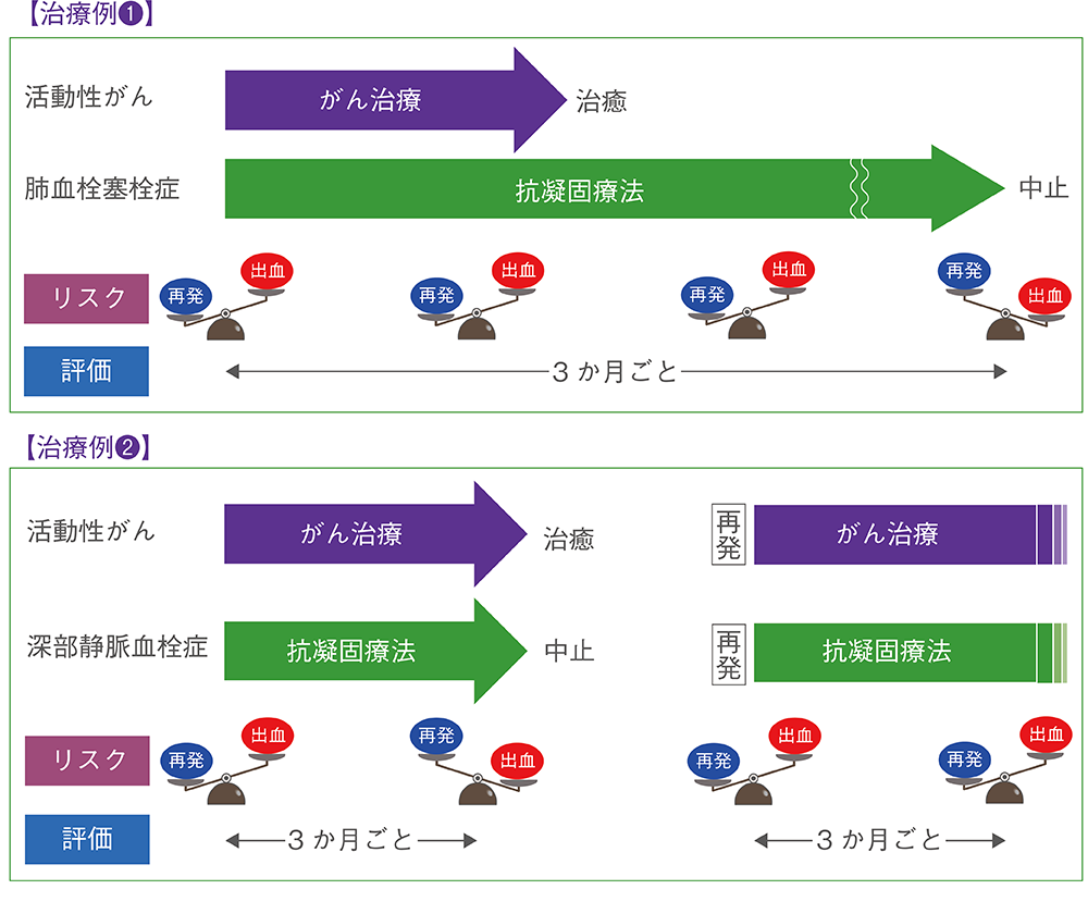 がん患者さんに対するDOACによる静脈血栓塞栓症治療例